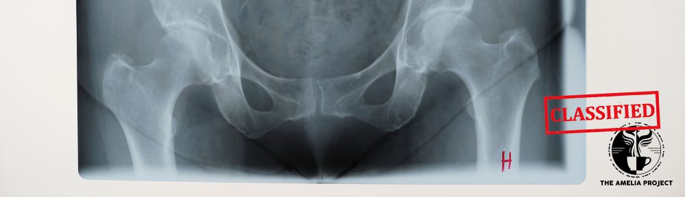 Øystein Ulsberg Brager